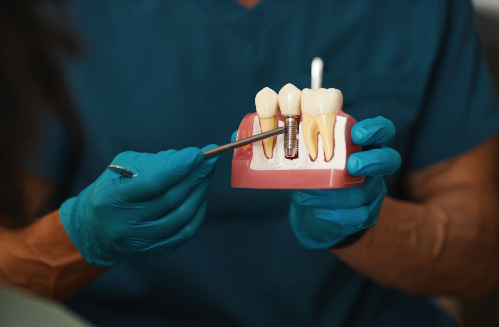 A dentist pointing at a dental implant
