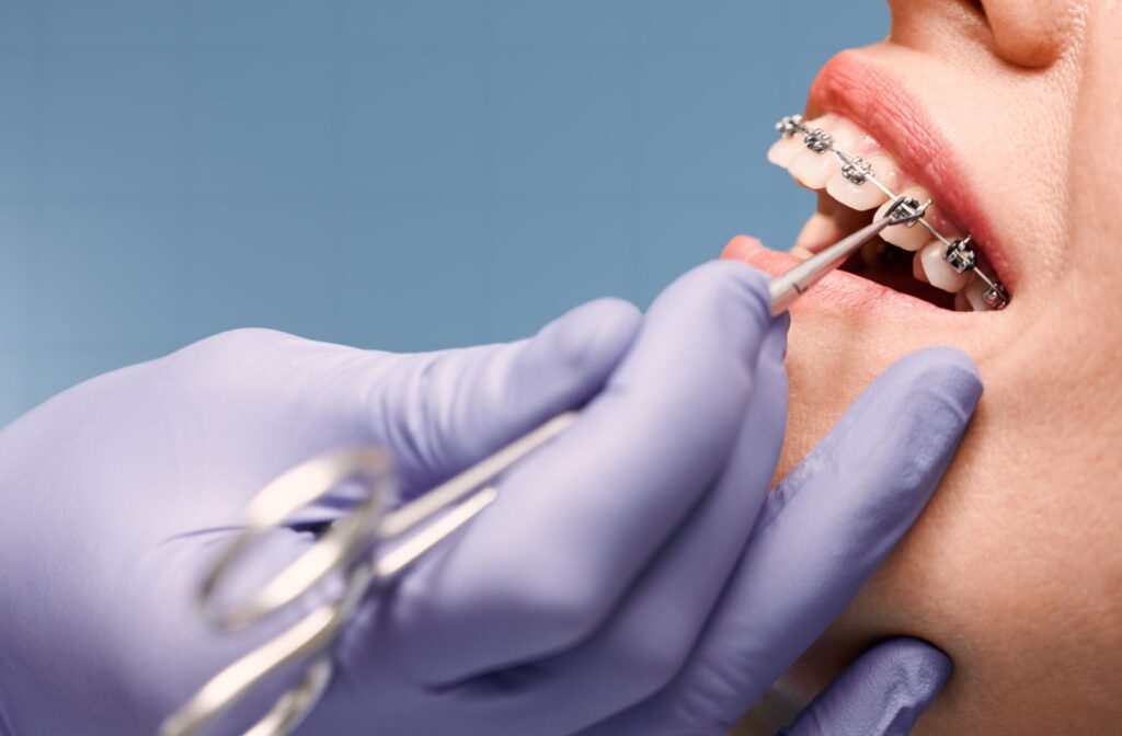 A dental patient having their braces adjusted